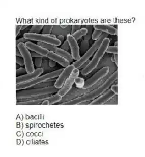 What kind of prokaryotes are these? 
A) bacilli 
B) spirochetes 
C) cocci 
D) ciliates
