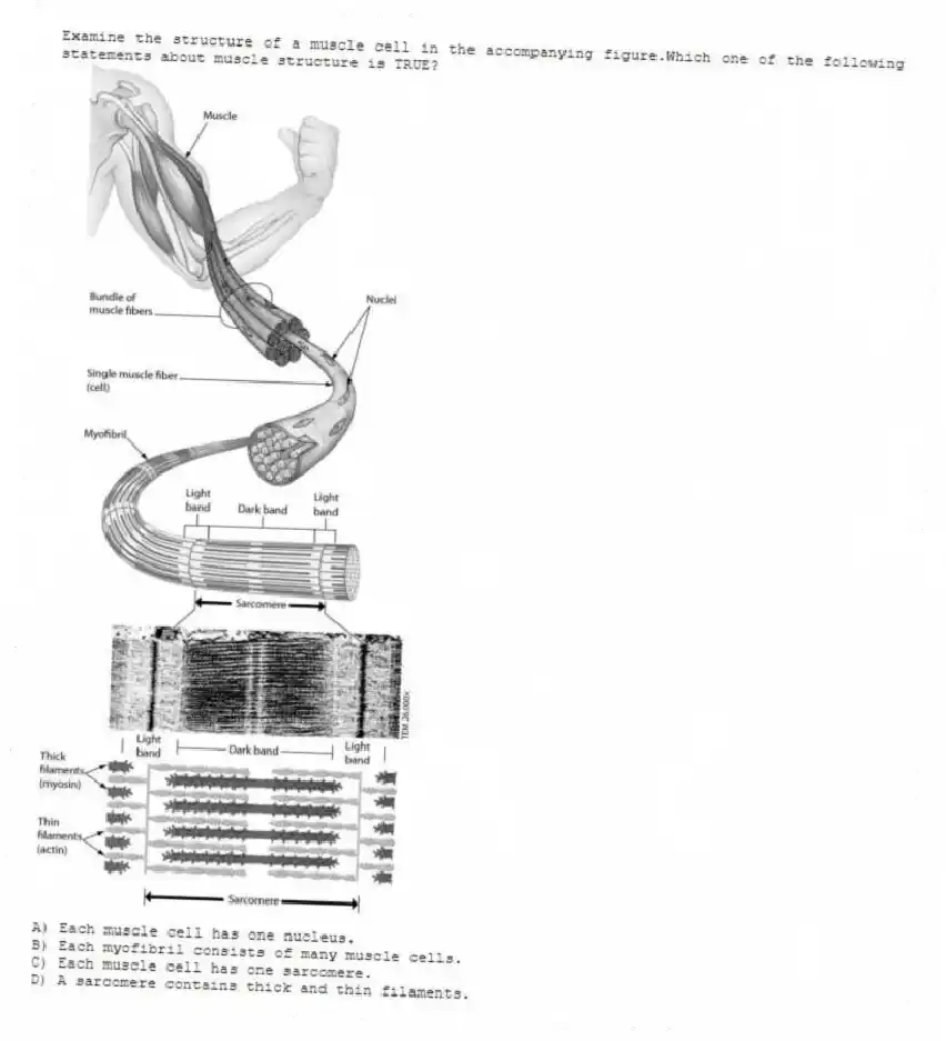 Examine the structure of a muscle cell in the accompanying figure.Which one of the following statements about muscle structure is TRUE?
A) Each muscle cell has one nucleus.
B) Each myofibril consists of many muscle cells.
C) Each muscle cell has one sarcomere.
D) A sarcomere contains thick and thin filaments.