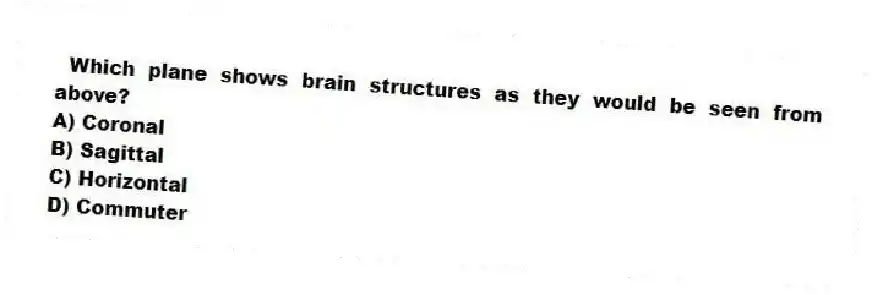 Which plane shows brain structures as they would be seen from above?
A) Coronal
B) Sagittal
C) Horizontal
D) Commuter