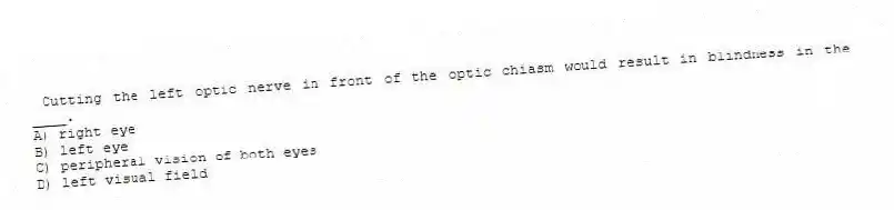 Cutting the left optic nerve in front of the optic chiasm would result in blindness in the ____.
A) right eye
B) left eye
C) peripheral vision of both eyes
D) left visual field