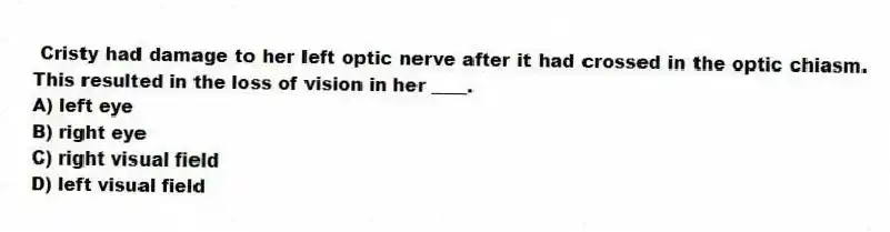  Cristy had damage to her left optic nerve after it had crossed in the optic chiasm. This resulted in the loss of vision in her ____.
A) left eye
B) right eye
C) right visual field
D) left visual field