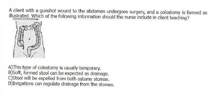 A client with a gunshot wound to the abdomen undergoes surgery, and a colostomy is formed as illustrated. Which of the following information should the nurse include in client teaching?
A)This type of colostomy is usually temporary.
B)Soft, formed stool can be expected as drainage.
C)Stool will be expelled from both ostomy stomas.
D)Irrigations can regulate drainage from the stomas.