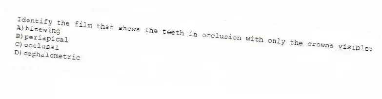 Identify the film that shows the teeth in occlusion with only the crowns visible:
A)bitewing
B)periapical
C)occlusal
D)cephalometric