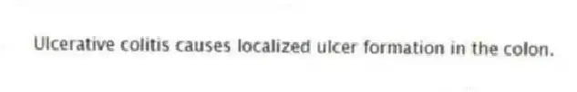 Ulcerative colitis causes localized ulcer formation in the colon.