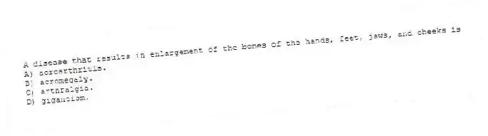 A disease that results in enlargement of the bones of the hands, feet, jaws, and cheeks is
A) acroarthritis.
B) acromegaly.
C) arthralgia.
D) gigantism.