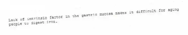 Lack of intrinsic factor in the gastric mucosa makes it difficult for aging people to digest iron.