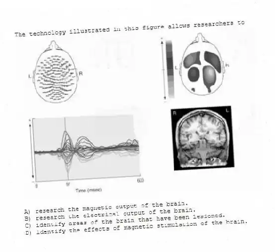 The technology illustrated in this figure allows researchers to
A) research the magnetic output of the brain.
B) research the electrical output of the brain.
C) identify areas of the brain that have been lesioned.
D) identify the effects of magnetic stimulation of the brain.