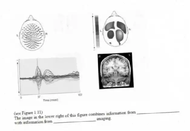 -(see Figure 1.11)
The image in the lower right of this figure combines information from ____________________ with information from ____________________ imaging.