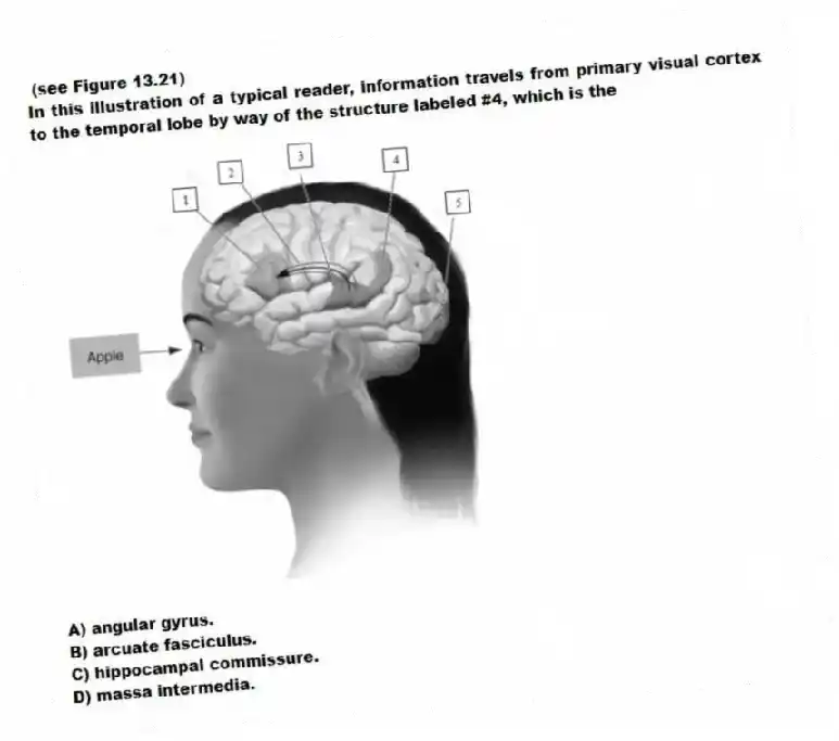 (see Figure 13.21)
In this illustration of a typical reader, information travels from primary visual cortex to the temporal lobe by way of the structure labeled #4, which is the
A) angular gyrus.
B) arcuate fasciculus.
C) hippocampal commissure.
D) massa intermedia.