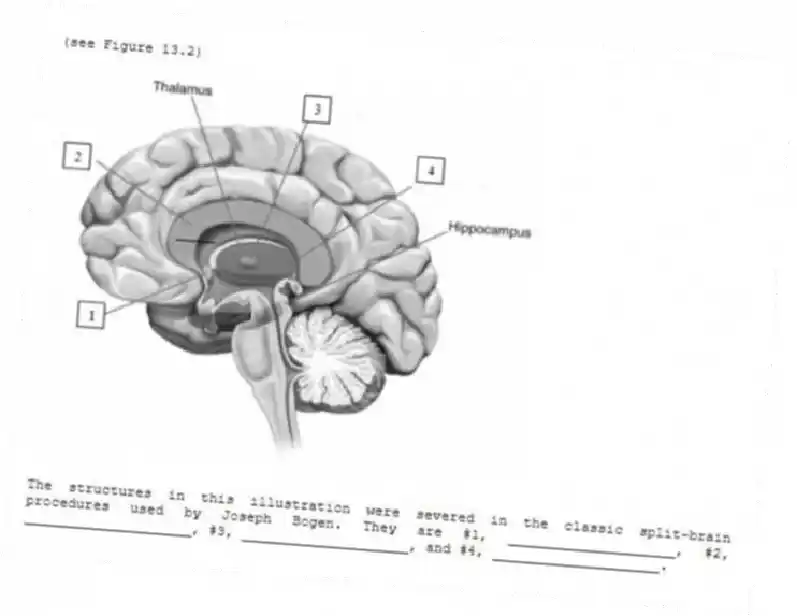 (see Figure 13.2)
-
The structures in this illustration were severed in the classic split-brain procedures used by Joseph Bogen. They are #1, ____________________, #2, ____________________, #3, ____________________, and #4, ____________________.