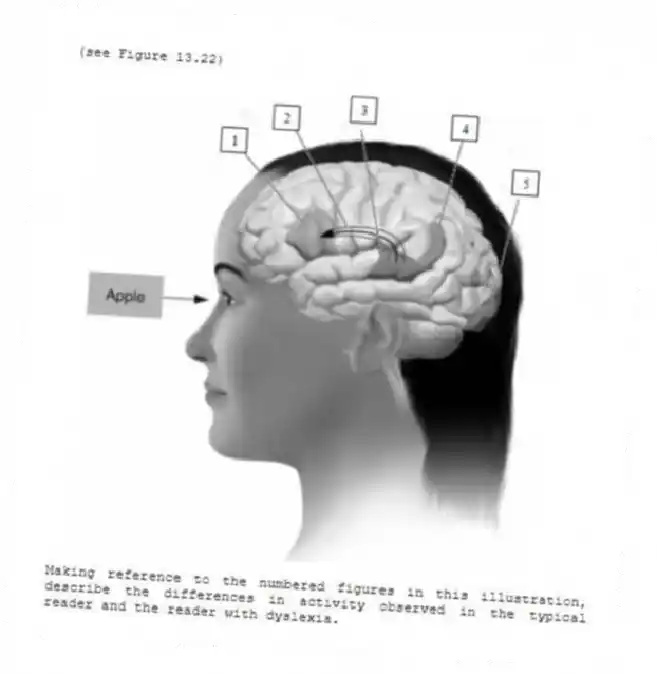 (see Figure 13.22)
-Making reference to the numbered figures in this illustration, describe the differences in activity observed in the typical reader and the reader with dyslexia.