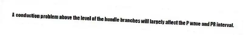 A conduction problem above the level of the bundle branches will largely affect the P wave and PR interval.