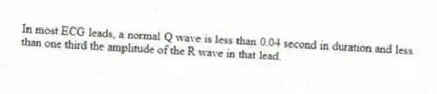 In most ECG leads, a normal Q wave is less than 0.04 second in duration and less than one third the amplitude of the R wave in that lead.