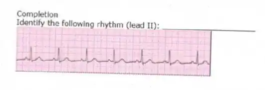 Completion
-Identify the following rhythm (lead II): ____________________