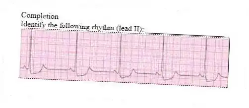 Completion
-Identify the following rhythm (lead II): ____________________
