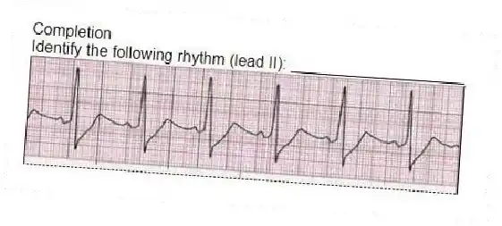 Completion
-Identify the following rhythm (lead II): ____________________
 