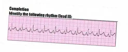 Completion
-Identify the following rhythm (lead II): ____________________