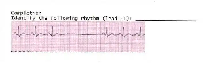 Completion
-Identify the following rhythm (lead II): ____________________