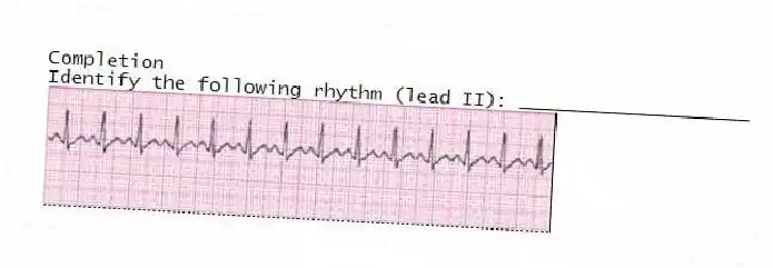 Completion
-Identify the following rhythm (lead II): ____________________