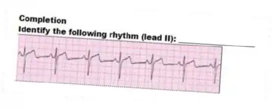 Completion
-Identify the following rhythm (lead II): ____________________
