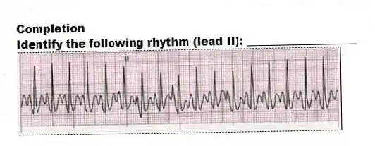 Completion
-Identify the following rhythm (lead II): ____________________