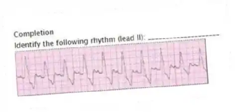 Completion
-Identify the following rhythm (lead II): ____________________