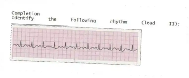 Completion
-Identify the following rhythm (lead II): ____________________