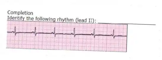 Completion
-Identify the following rhythm (lead II): ____________________