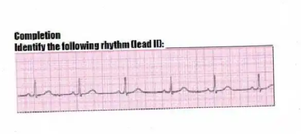 Completion
-Identify the following rhythm (lead II): ____________________
