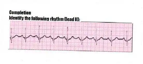 Completion
-Identify the following rhythm (lead II): ____________________