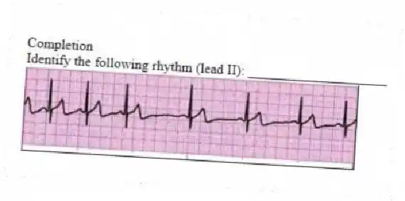 Completion
-Identify the following rhythm (lead II): ____________________