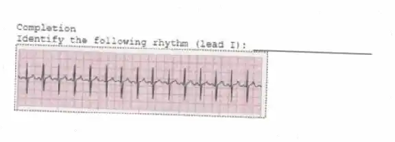 Completion
-Identify the following rhythm (lead I): ____________________