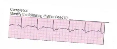 Completion
-Identify the following rhythm (lead II): ____________________