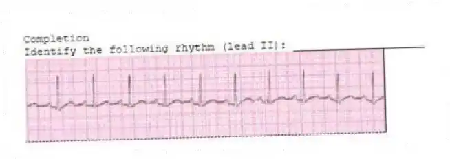 Completion
-Identify the following rhythm (lead II): ____________________