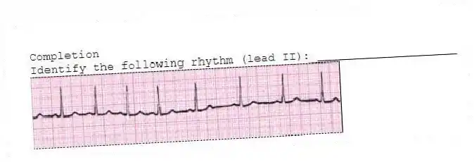 Completion
-Identify the following rhythm (lead II): ____________________