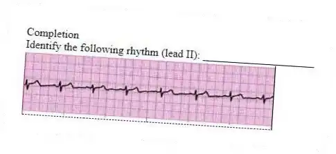 Completion
-Identify the following rhythm (lead II): ____________________