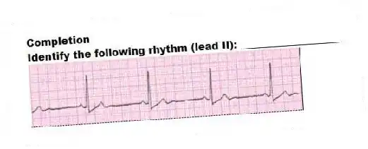 Completion
-Identify the following rhythm (lead II): ____________________
 