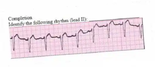 Completion
-Identify the following rhythm (lead II): ____________________