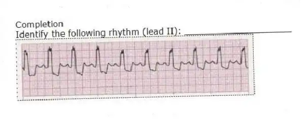Completion
-Identify the following rhythm (lead II): ____________________