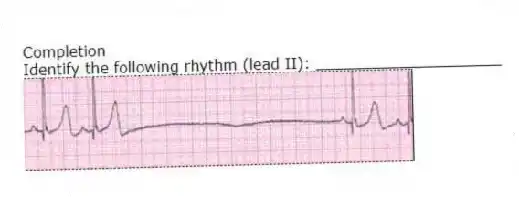 Completion
-Identify the following rhythm (lead II): ____________________