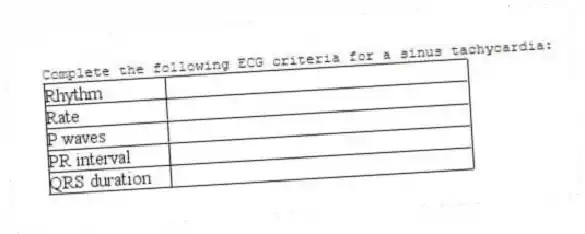 Complete the following ECG criteria for a sinus tachycardia: