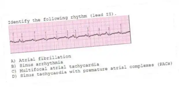 Identify the following rhythm (lead II).
A) Atrial fibrillation
B) Sinus arrhythmia
C) Multifocal atrial tachycardia
D) Sinus tachycardia with premature atrial complexes (PACs)