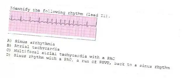 Identify the following rhythm (lead II).
A) Sinus arrhythmia
B) Atrial tachycardia
C) Multifocal atrial tachycardia with a PAC
D) Sinus rhythm with a PAC, a run of PSVT, back to a sinus rhythm