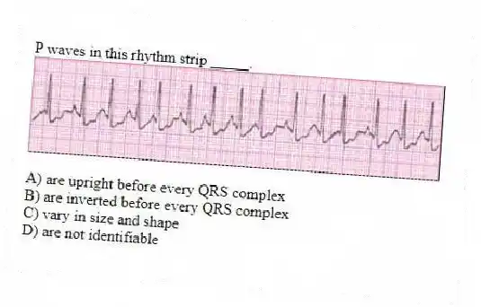 P waves in this rhythm strip _____.
A) are upright before every QRS complex
B) are inverted before every QRS complex
C) vary in size and shape
D) are not identifiable