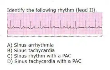 Identify the following rhythm (lead II).
A) Sinus arrhythmia
B) Sinus tachycardia
C) Sinus rhythm with a PAC
D) Sinus tachycardia with a PAC