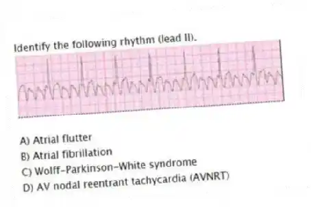 Identify the following rhythm (lead II).
A) Atrial flutter
B) Atrial fibrillation
C) Wolff-Parkinson-White syndrome
D) AV nodal reentrant tachycardia (AVNR