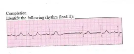 Completion
-Identify the following rhythm (lead II): ____________________