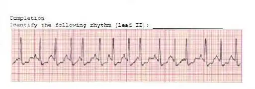 Completion
-Identify the following rhythm (lead II): ____________________