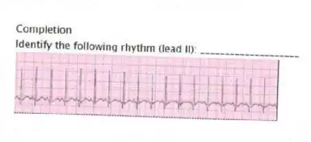 Completion
-Identify the following rhythm (lead II): ____________________