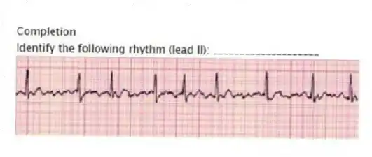 Completion
-Identify the following rhythm (lead II): ____________________
